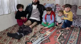 Savaşın izini vücudunda taşıyor