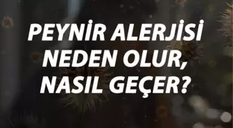 Peynir Alerjisi Nedir, Neden Olur ve Nasıl Geçer? Peynir Alerjisi Belirtileri ve Tedavisi Hakkında Bilgi