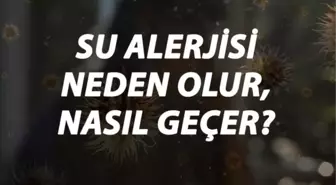 Su Alerjisi Nedir, Neden Olur ve Nasıl Geçer? Su Alerjisi Belirtileri ve Tedavisi Hakkında Bilgi