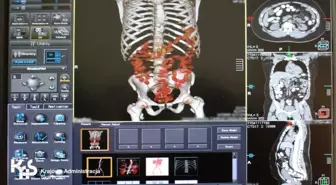 Varşova'da havaalanında yakalanan kaçakçının midesinden eroin çıktı