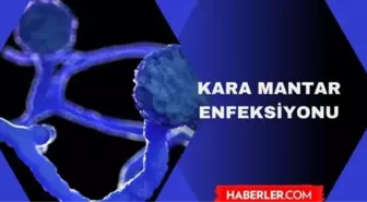 Kara mantar hastalığı bulaşıcı mı? Kara mantar enfeksiyonu nedir?