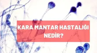Kara mantar hastalığı nedir? Kara mantar hastalığı belirtileri nelerdir?
