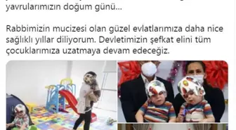 İngiltere'de operasyonla ayrılan siyam ikizleri 3 yaşında (2)