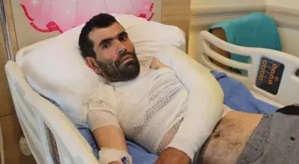 Banyo yaparken sıcak suyla yanan Yasin Ergeni'nin tedavisi sürüyor