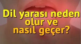 Dil yarasına ne iyi gelir, neden olur, nasıl ve kaç günde geçer? Dil yarasına evde kesin çözüm önerileri