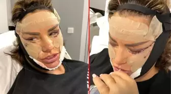 Katie Price estetiğe doyamıyor, eski kocası kızdı: Bari biraz çocuklarını düşün!