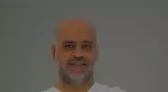Saç ekiminde doğru bilinen yanlışlar