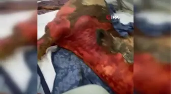 'Uyutun yaşamaz' dediler, vücudunun yarısı yanan tosun hayata tutundu