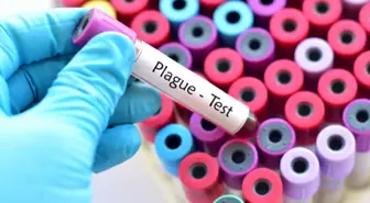 Veba nedir? Veba hastalığı belirtileri, teşhisi ve tedavisi nasıl olmalıdır?