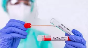 Aşısızlar, PCR test laboratuvarlarının yükünü artırıyor