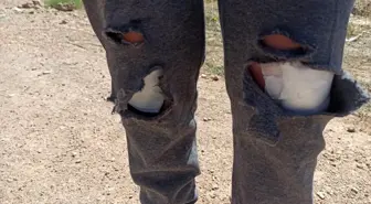 Başkent'te başıboş köpeklerin saldırısına uğrayan kadın canını zor kurtardı