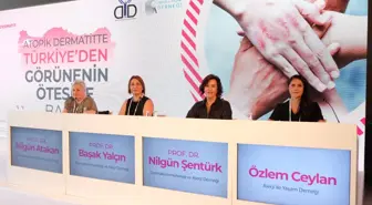 Türkiye'de ilk kez yapılan 'atopik dermatit' araştırmasının sonuçları paylaşıldı