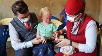 Son dakika haberi | THY, güneşten saklanan albino hastası çocukların yaralarına merhem oldu