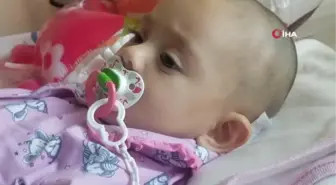 10 aylık bebeğin ensesinden 14 santimetrelik tümör çıkarıldı