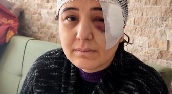 KORDON BOYUNDA YÜRÜRKEN MOTOSİKLET ÇARPTI