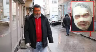 Kardeşi tarafından yüzü yakılan adamın anlattıkları kan dondurdu! 'Oh ne iyi yaptım' demiş