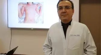 PROF. DR. SELÇUK YÜKSEL COVİD-19 ÇOCUKLARDA SAKLI VİRÜSLERİ TETİKLİYOR