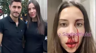 Özer Hurmacı'nın eşi Mihriban Hurmacı'dan darp iddiası! Kafasını cama vurup ''Seni gebertirim'' demiş