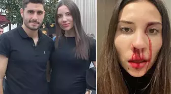 Eşini darp ettiği iddia edilen Özer Hurmacı'dan açıklama: Hepsi yalan