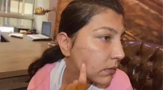 Mahkeme heyetinin kadın üyeleri, salonu boşaltıp Perkgün'ün yara izlerini inceledi