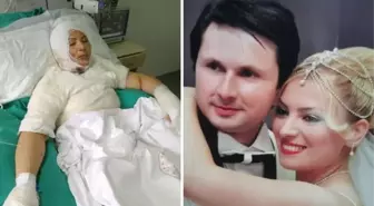 Eski eşi tarafından ateşe verilen talihsiz kadından kan donduran sözler: Söndürmeye çalışmadı, yanmamı izledi