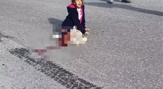 SAĞ BACAĞI KESİLEN MAHRA'NIN BABASI: KIZIMIN BEYİN ÖLÜMÜ GERÇEKLEŞEBİLİR