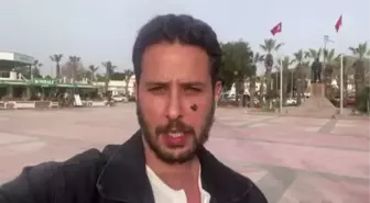 Bodrum'da köpeğin saldırısına uğrayan oyuncu Tuan Tunalı yaralandı