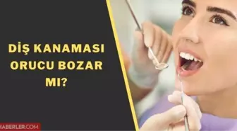 Diş kanarsa oruç bozulur mu? Diyanet: Diş kanayıp onu yuttuğumda orucum bozulur mu?