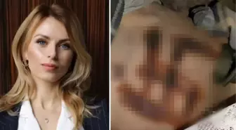 Vahşetin fotoğrafını Ukraynalı vekil paylaştı! Cinsel istismara uğradı, öldürüldü, cansız bedenine ateşle 'Gamalı haç' kazındı