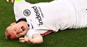 Eintracht Frankfurt - Rangers maçında yüreklerin ağza geldiği an! Yıldız futbolcu kanlar içinde yere yığıldı