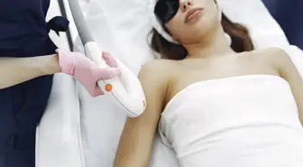 Yazın lazere gidilir mi? DİKKAT! Yaz aylarında epilasyon yapılır mı? Güneşlenince epilasyon lazer yapılır mı? Lazerden sonra güneşlenilir mi?