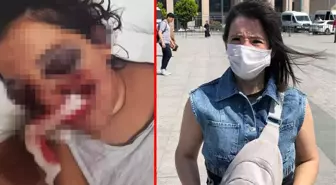 Tatilde ATV'ye bindi, sağ gözünü kaybetti! Yüzde 46 engelli kalan kadın şimdi adalet istiyor