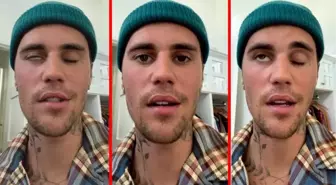 Justin Bieber yüz felci geçirdi! Sadece bir gözünü oynatabiliyor