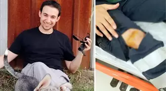 Sağlık çalışanının dizine makas saplayan saldırgan serbest bırakıldı