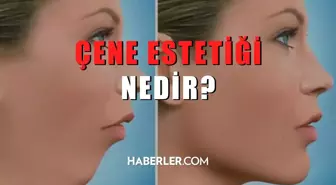 Çene estetiği nedir? Çene estetiği nasıl yapılır?