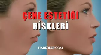 Çene estetiği riskleri nelerdir?