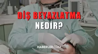 Diş beyazlatma nedir? Diş beyazlatma nasıl yapılır?