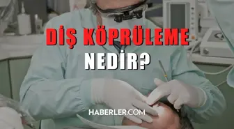 Diş köprüleme nedir? Diş köprüleme nasıl yapılır?