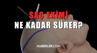 Saç ekimi ne kadar sürer?