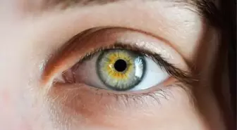 Göz kuruluğu neden olur? Göz kuruluğuna ne iyi gelir? Göz kuruluğu belirtileri nedir?