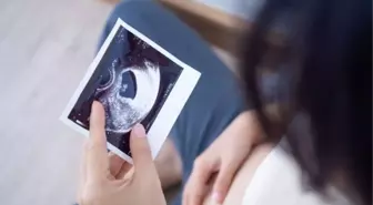 'Akraba evliliklerinde fetal anomalilerin anne karnında tanısı mümkün olabiliyor'
