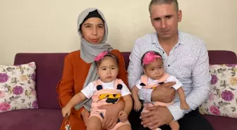 Tek yumurta ikizleri, anne karnındaki lazer tedavisiyle hayata tutundu