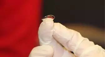 Doç. Dr. Kılıç: Kontakt lens, göz kapağını düşürebilir