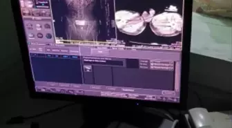 Ağrı'da iç organlarından uyuşturucu çıkarılan 4 zanlı tutuklandı