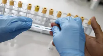 Konak'ta Ücretsiz Test