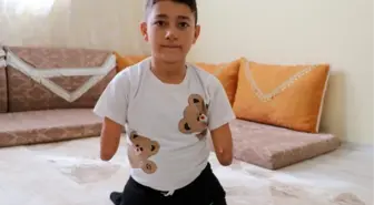 NAKŞİN'İN TEK İSTEĞİ PROTEZ KOL VE BACAK