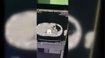 Ağrı'da vücudunda uyuşturucu taşıyan İranlı tutuklandı