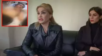 Göğüslerini küçültmek isteyen kadın, ameliyat masasından kalkınca gözlerine inanamadı