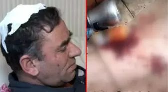 Dükkanı basan yeğen, tekmelerle amcasının belini kırdı, yetmedi kafa derisini yüzdü! Bütün bu dehşetin tek bir nedeni var