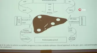 Sağlık Bakanlığı Karaciğer Nakli Bilim Kurulu Başkanı Prof. Dr. Polat: 'Türkiye'de 6 bin civarı organ nakli yapılıyor'